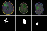 Brain image segmentation with torch